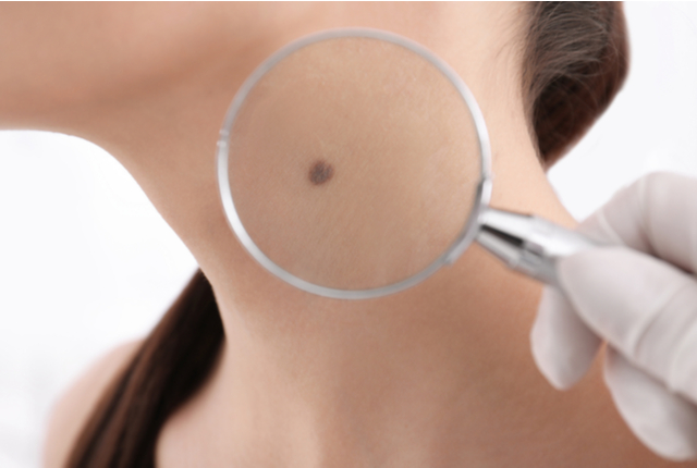 konkatsu-mole-fotune-telling2