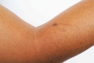 konkatsu-mole-fotune-telling4