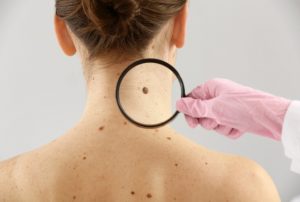 konkatsu-mole-fotune-telling